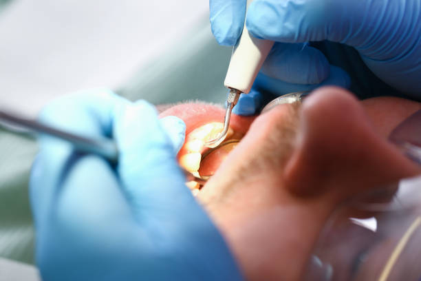 Best Urgent Tooth Repair  in Trenton, GA